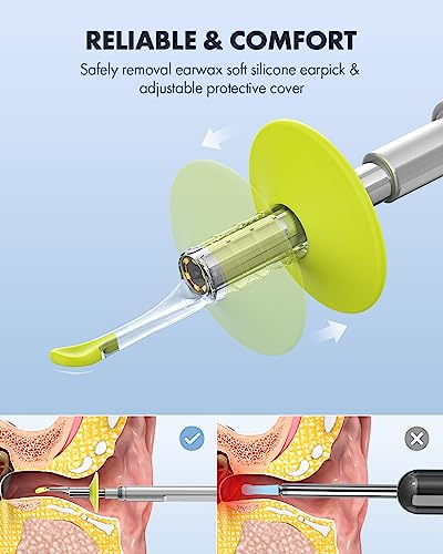 Digital Otoscope with 4.5 Inch Screen and Ear Wax Removal Camera C351