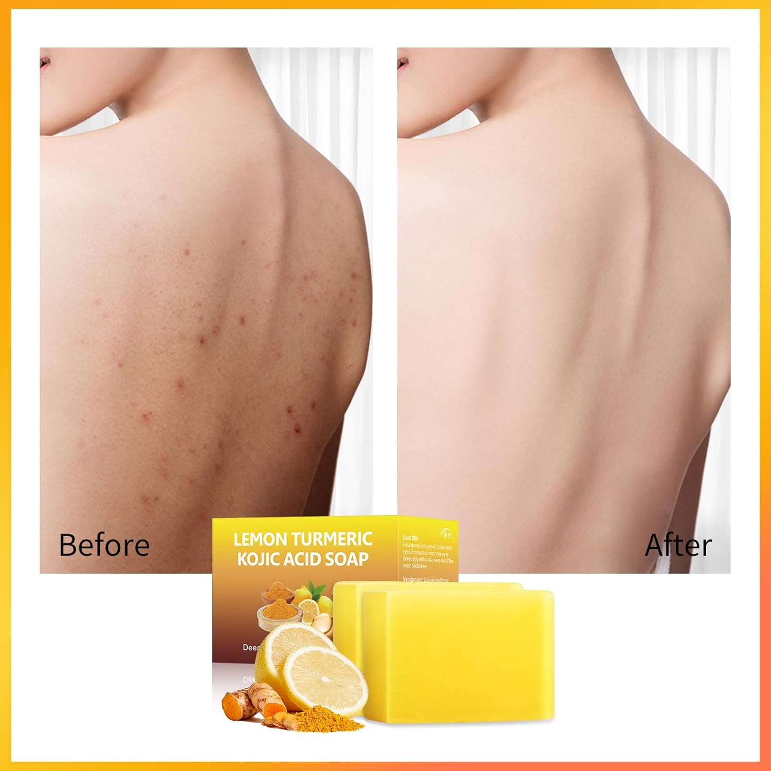 Lemon Turmeric Kojic Acid Soap Bar for Dark Spots and Hyperpigmentation, 2 Pack V9557
