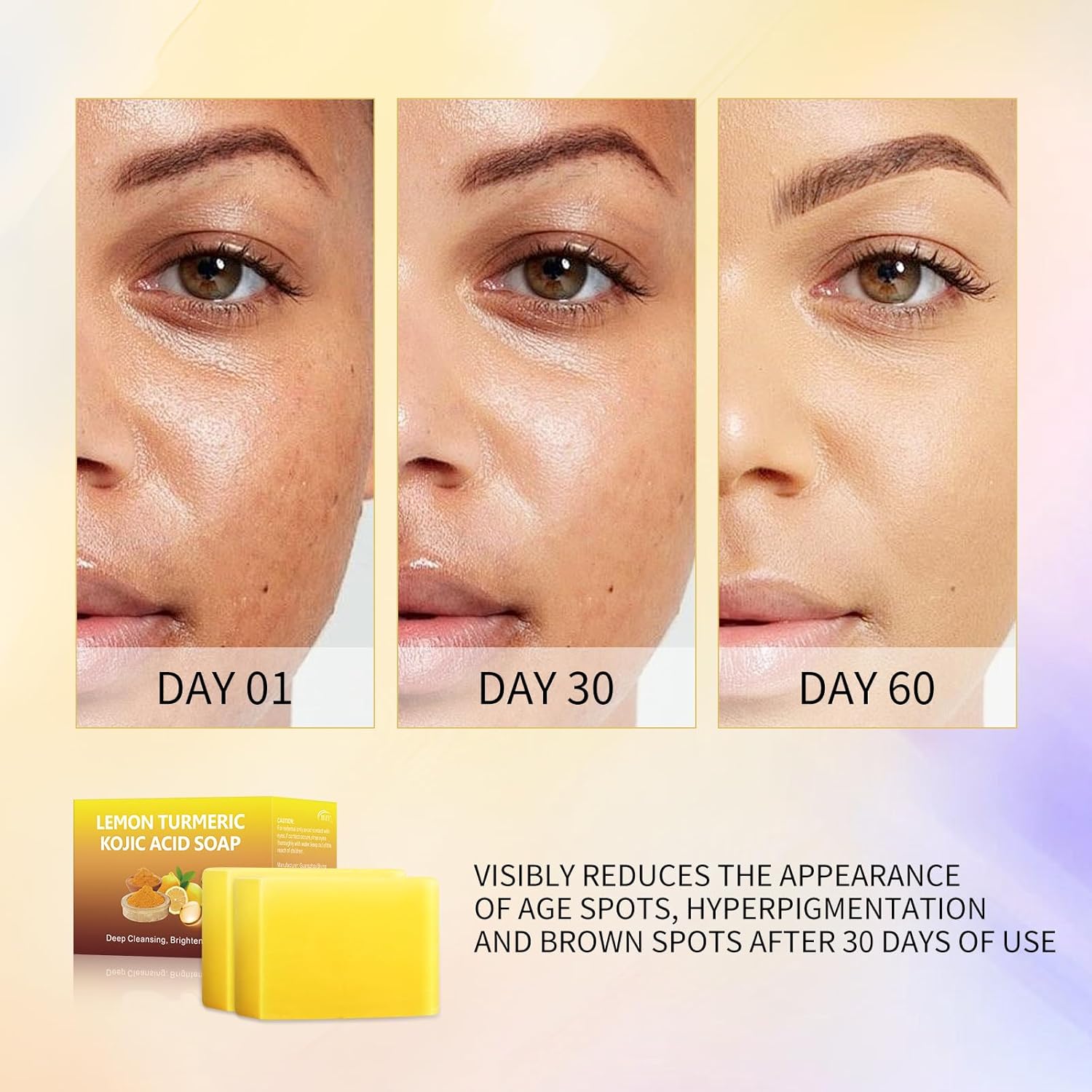 Lemon Turmeric Kojic Acid Soap Bar for Dark Spots and Hyperpigmentation, 2 Pack V9557